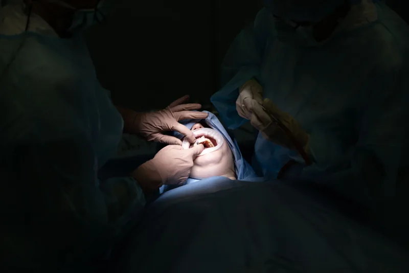 Dental implants Poland