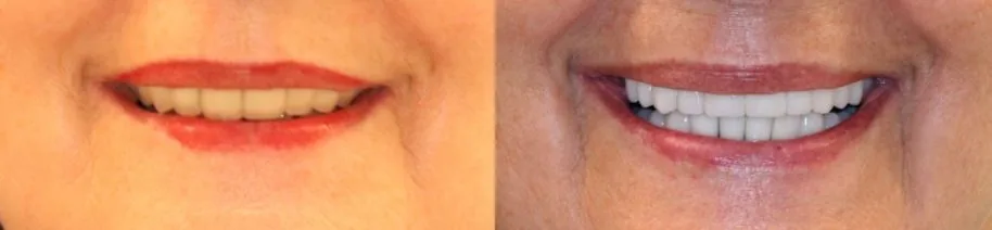 Single-visit transformation — before and after